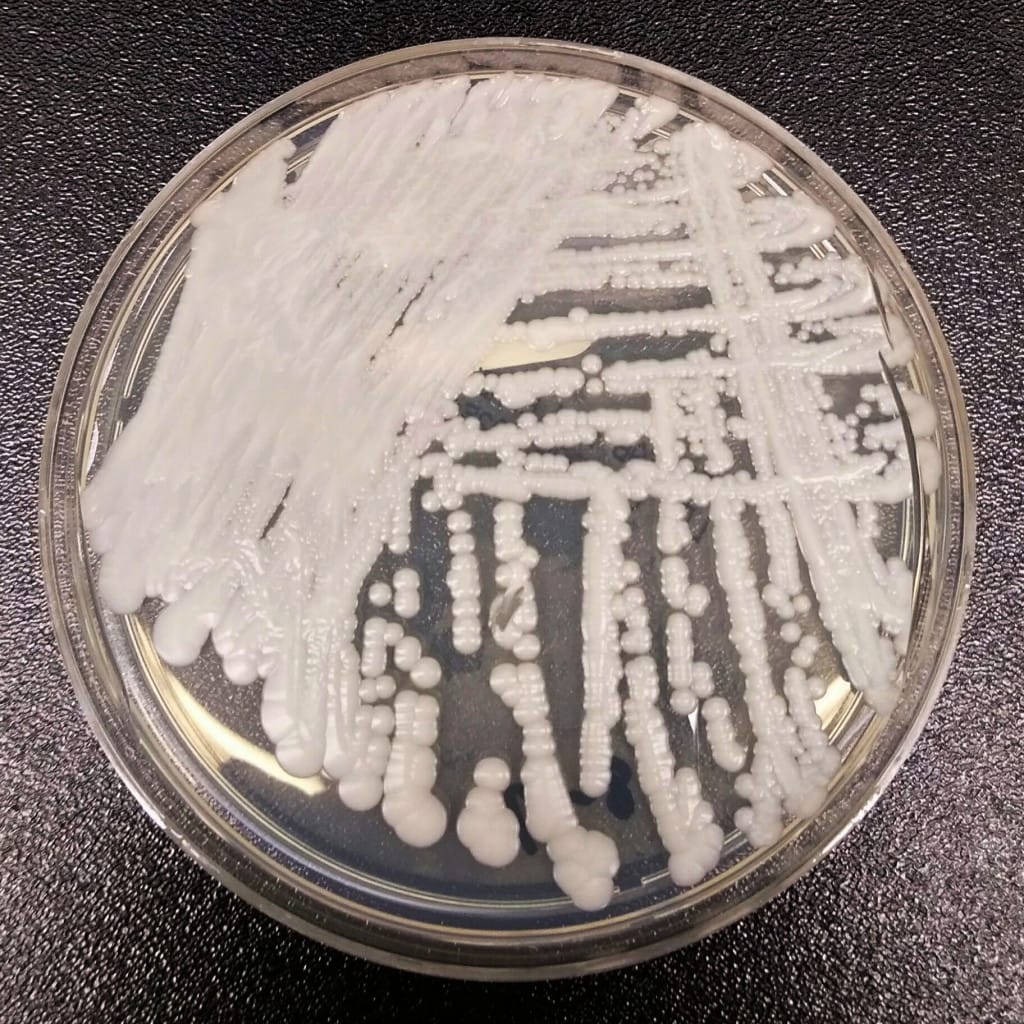 Cultivo de hongos en laboratorio para el diagnóstico de la onicomicosis