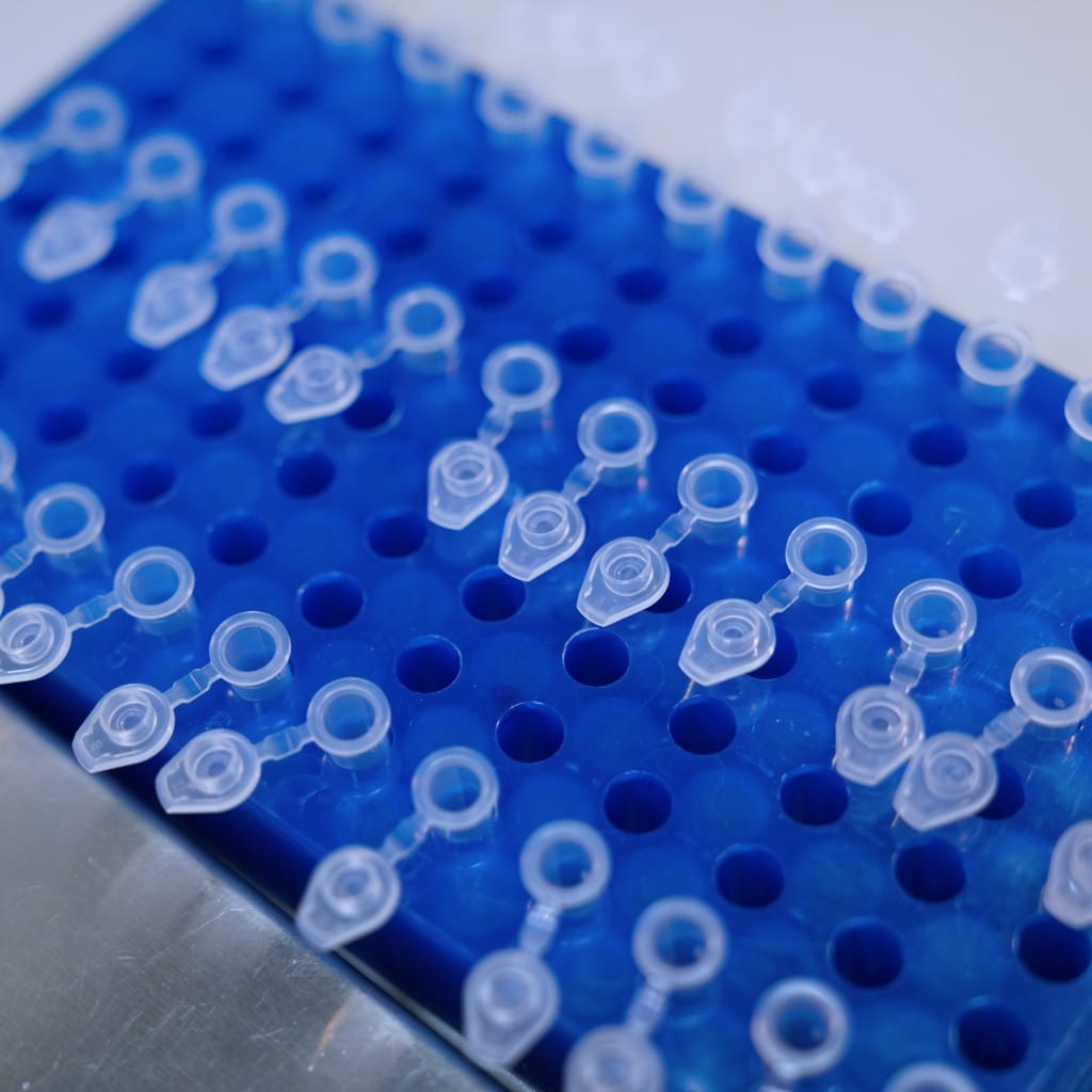 Prueba PCR en laboratorio para confirmar el diagnóstico de herpes zóster