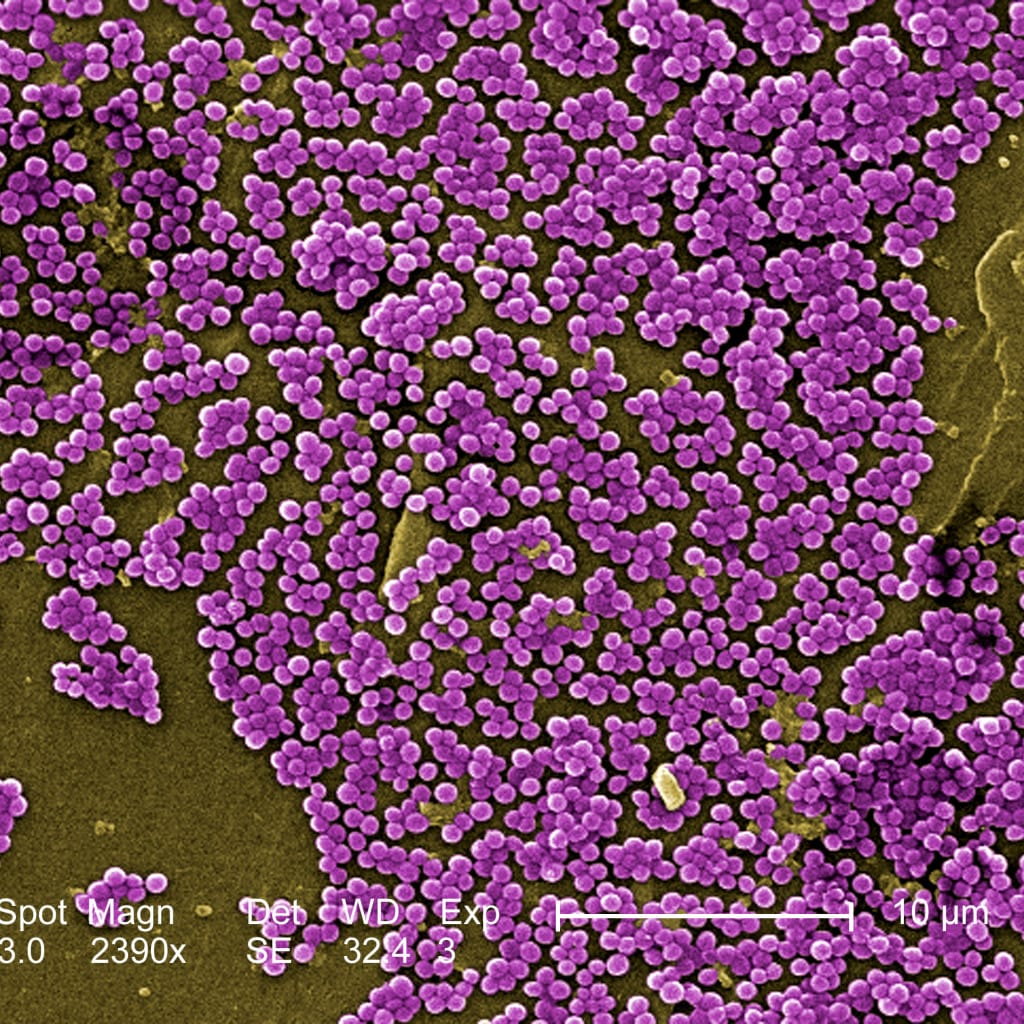 Bacteria Staphylococcus aureus vista al microscopio electrónico
