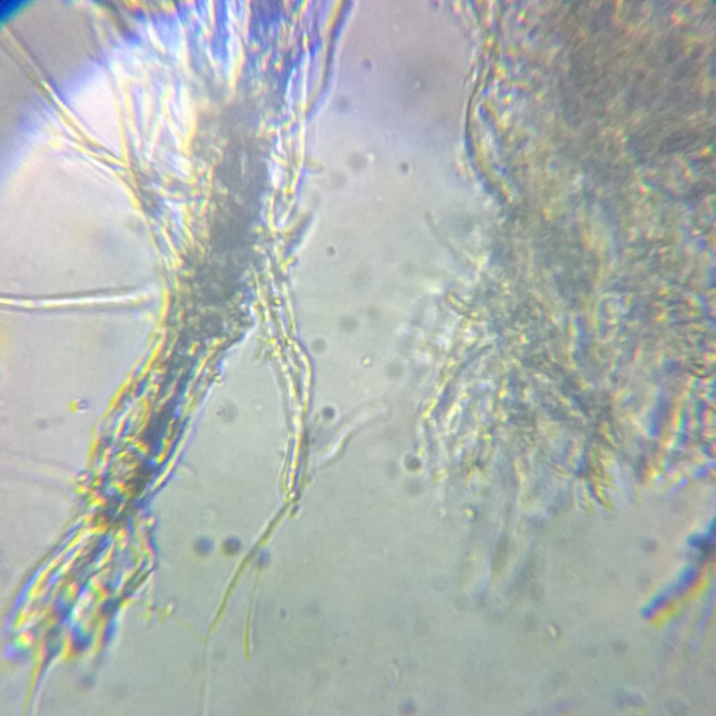Examen al microscopio de una muestra con hifas de hongo