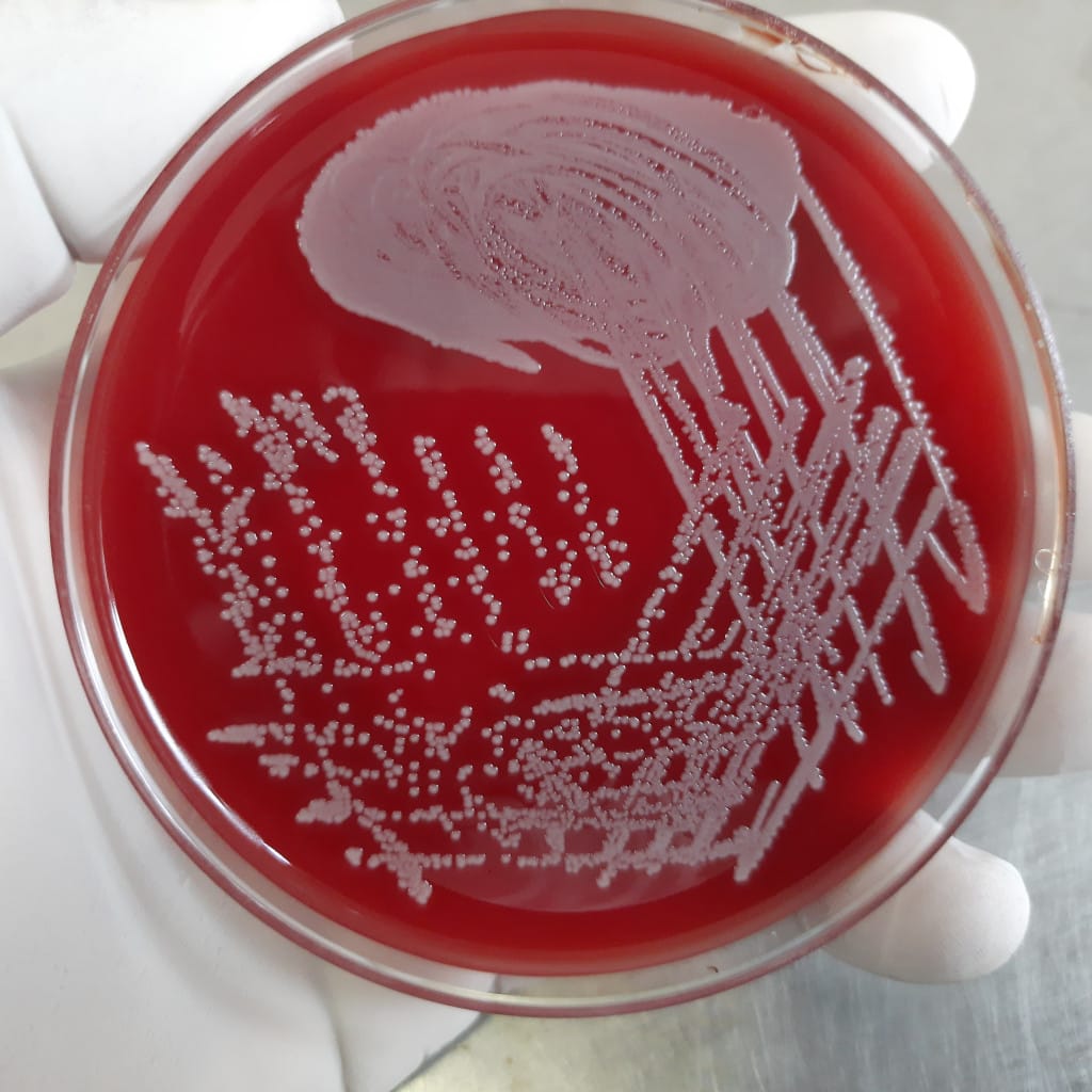 Cultivo bacteriano de Staphylococcus aureus en placa de agar sangre