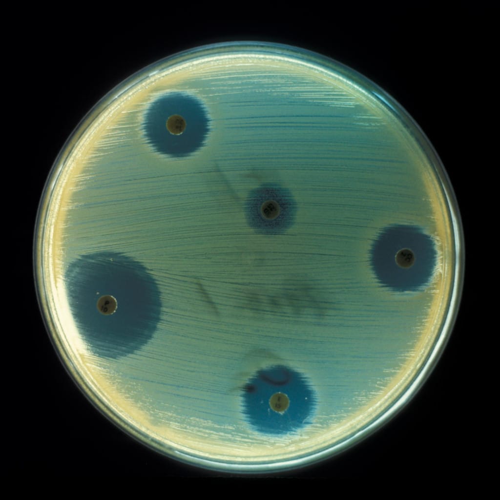 Antibiograma para elegir el antibiótico adecuado contra Staphylococcus aureus