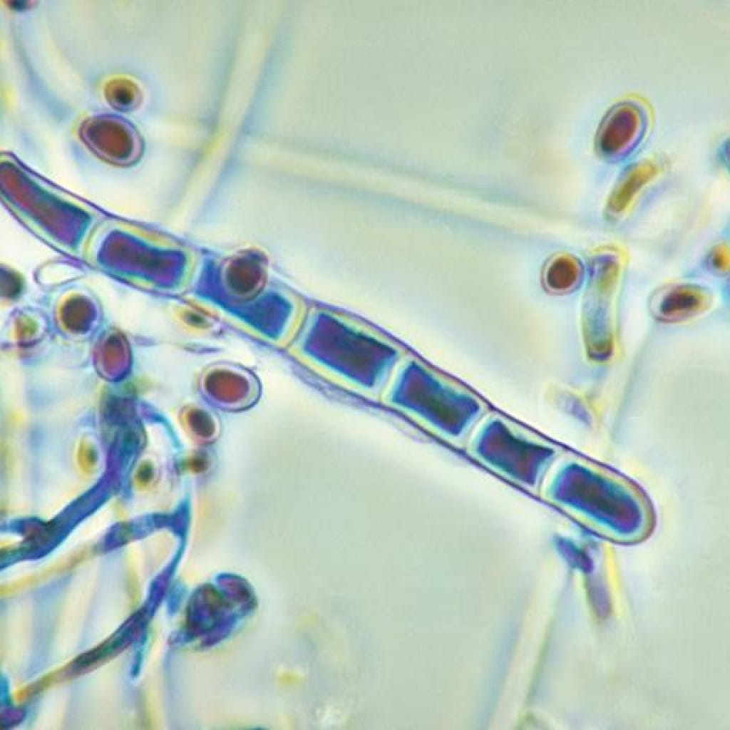 Hongo dermatofito Trichophyton rubrum visto al microscopio