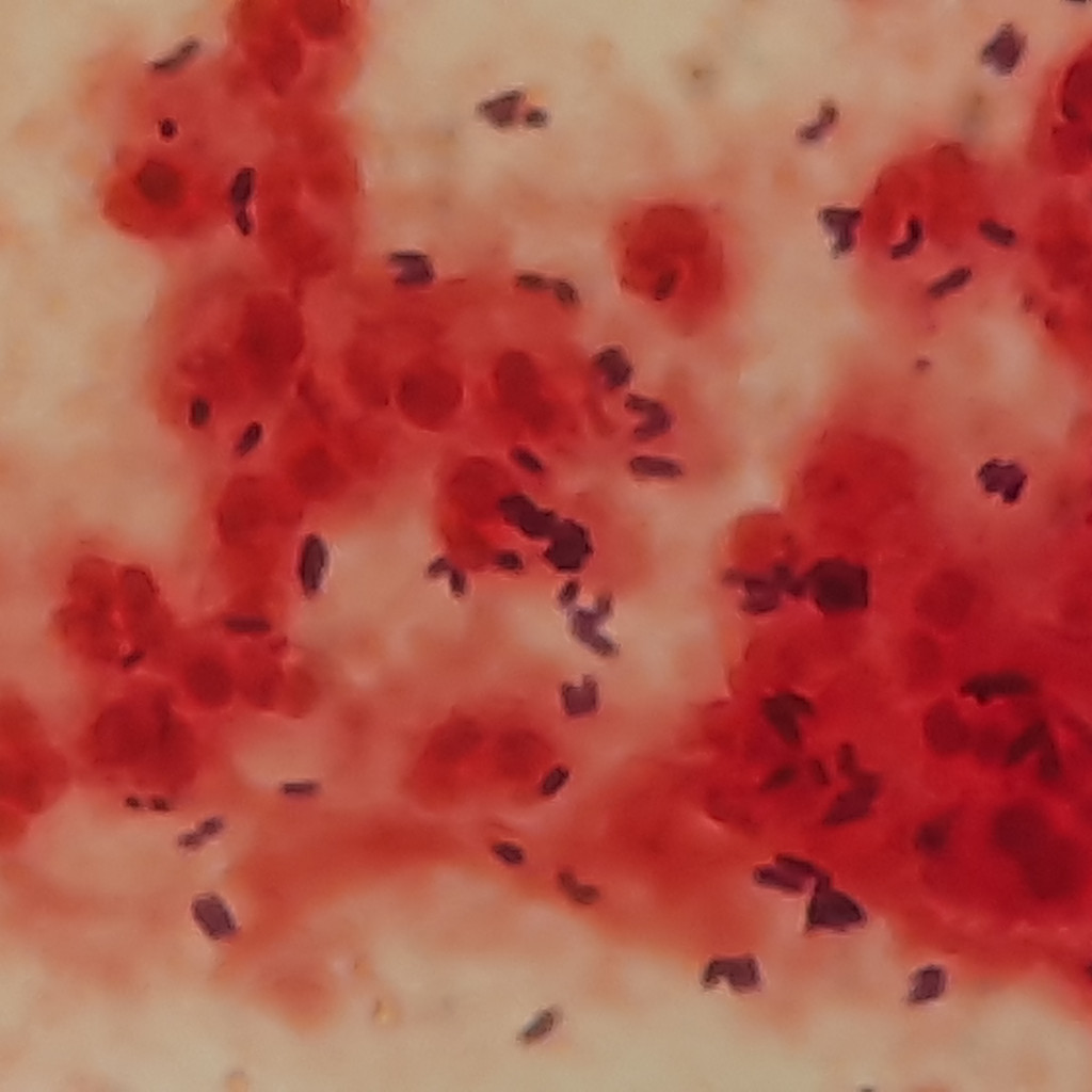 bacterias del género Corynebacterium vistas al microscopio con tinción de Gram, el tipo de bacteria que causa el eritrasma