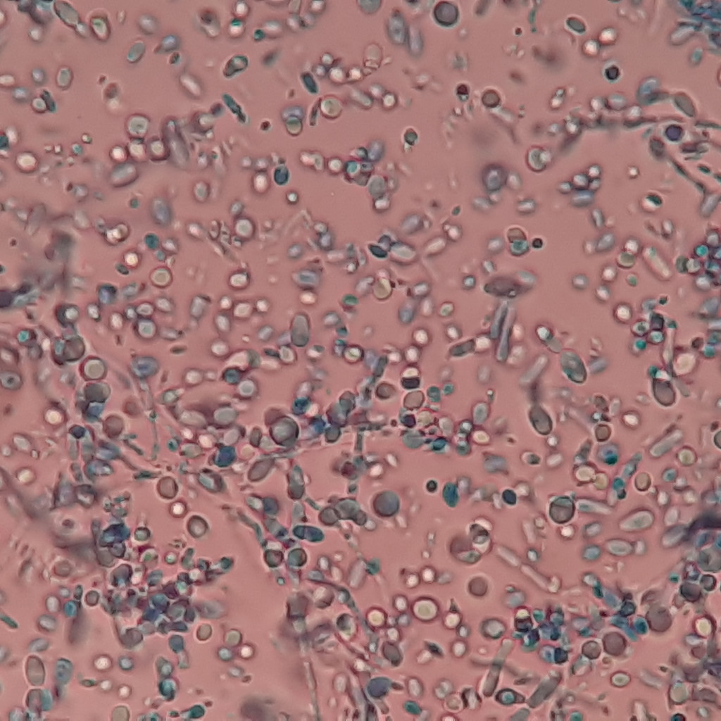 imagen al microscopio de la levadura Malassezia, causante de la pitiriasis versicolor