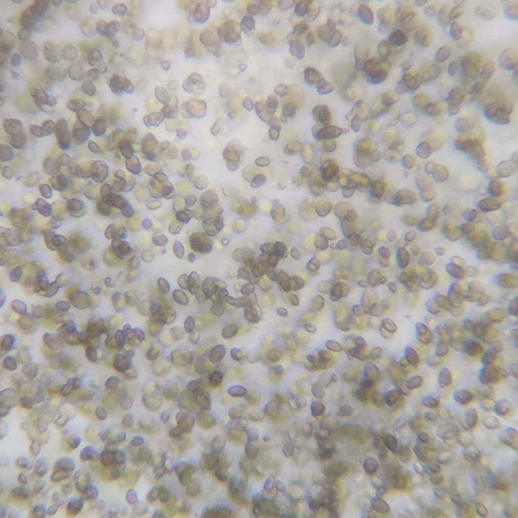 levaduras de Candida albicans vistas al microscopio, el hongo que causa la candidiasis cutánea
