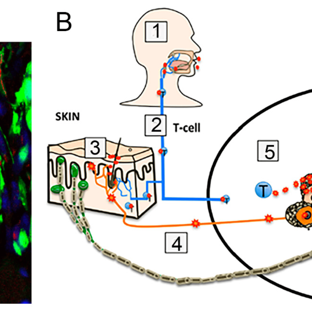 imagen al microscopio de tejido nervioso infectado por el virus varicela-zóster, que queda latente tras la varicela