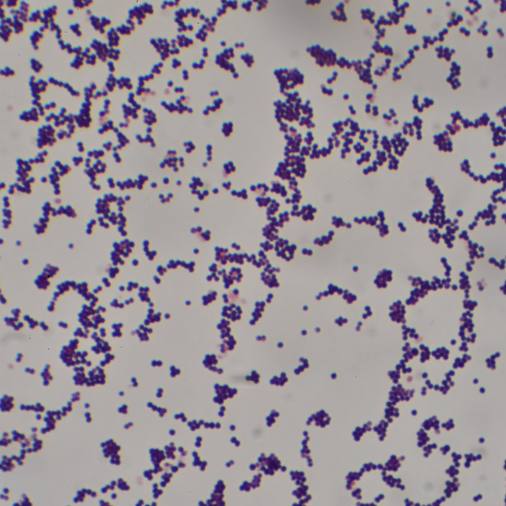 bacterias Staphylococcus aureus vistas al microscopio con tinción de Gram, una de las causas del impétigo