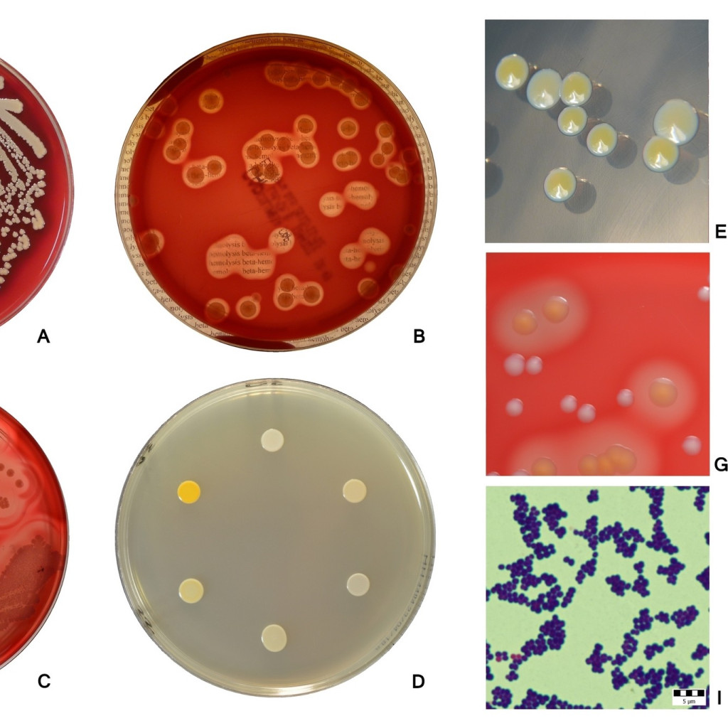 cultivo de bacterias en agar en el laboratorio, que identifica la bacteria y los antibióticos eficaces