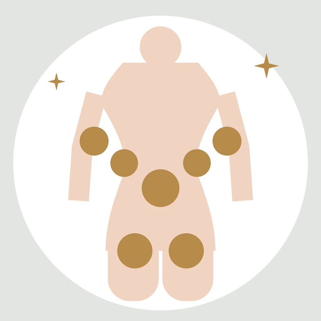 Ilustración de un cuerpo con las zonas de aplicación marcadas: abdomen, flancos, brazos y muslos