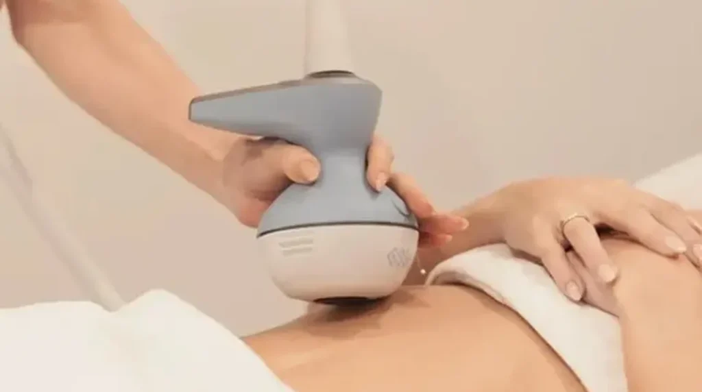EXION Body en Panamá: aplicación del cabezal de radiofrecuencia y ultrasonido sobre el abdomen de un paciente