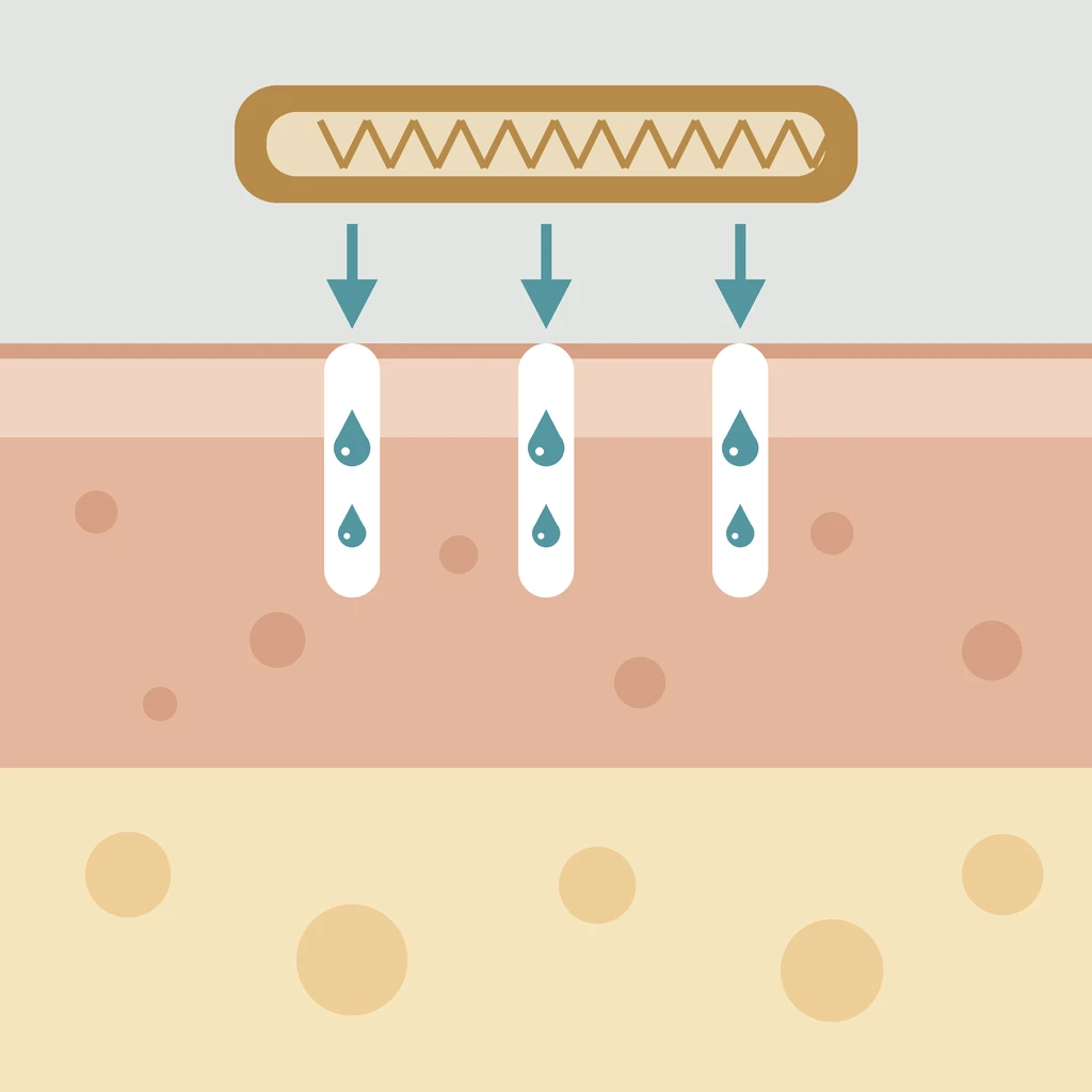 Ilustración de las capas de la piel con microcanales por los que penetran los activos de la mesoterapia sin agujas